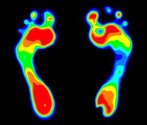 Scopri di più sull'articolo Indagini diagnostiche per il piede: Bio Postural Test e Pedana baropodometrica