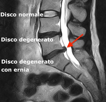 Read more about the article Esame diagnostico per il mal di schiena