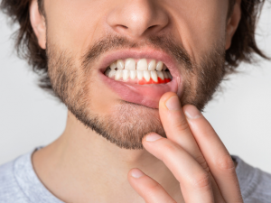 Read more about the article Pulpite dentale: cos’è e come curarla