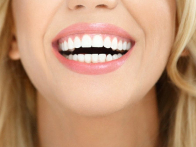 Scopri di più sull'articolo Sbiancare i denti velocemente grazie all’ablazione del tartaro