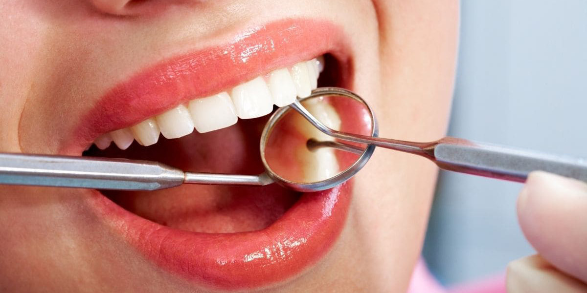 sensibilita dentinale medical group