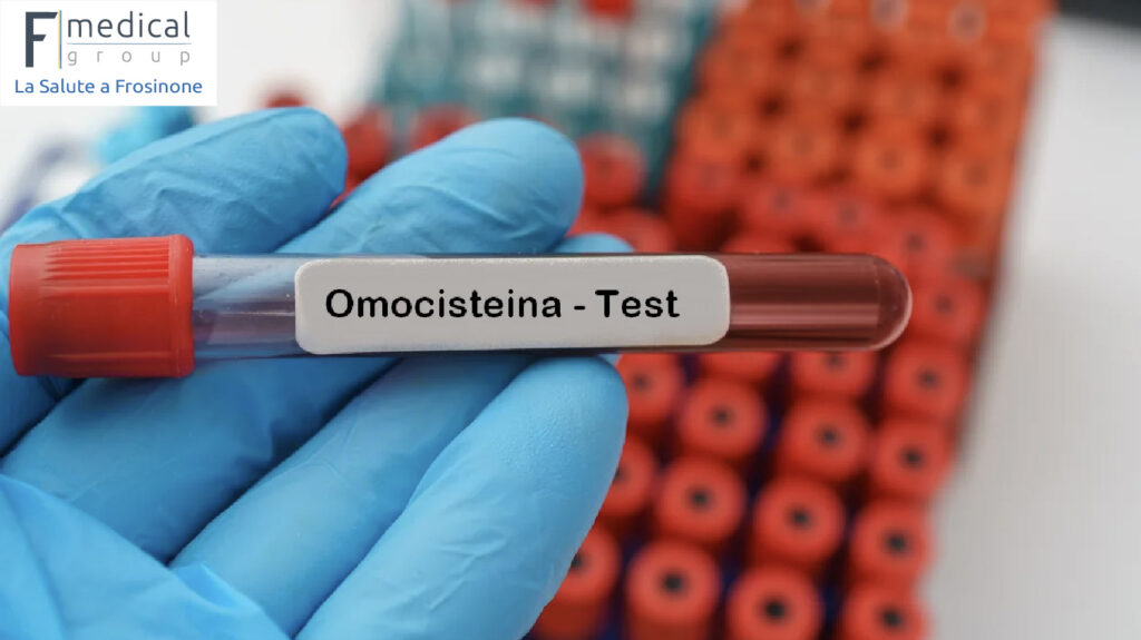 l'importanza dell'omocisteina come analisi f medical group frosinone