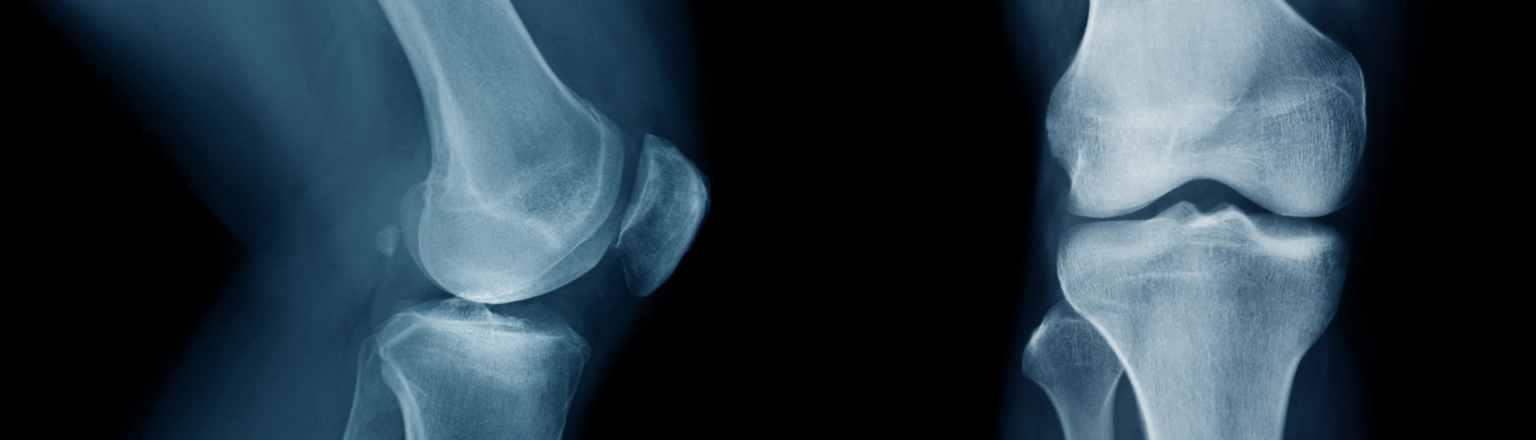 Rotula Axial Rx Rx Assiali di Rotula nei Centri del Medical Group Italia