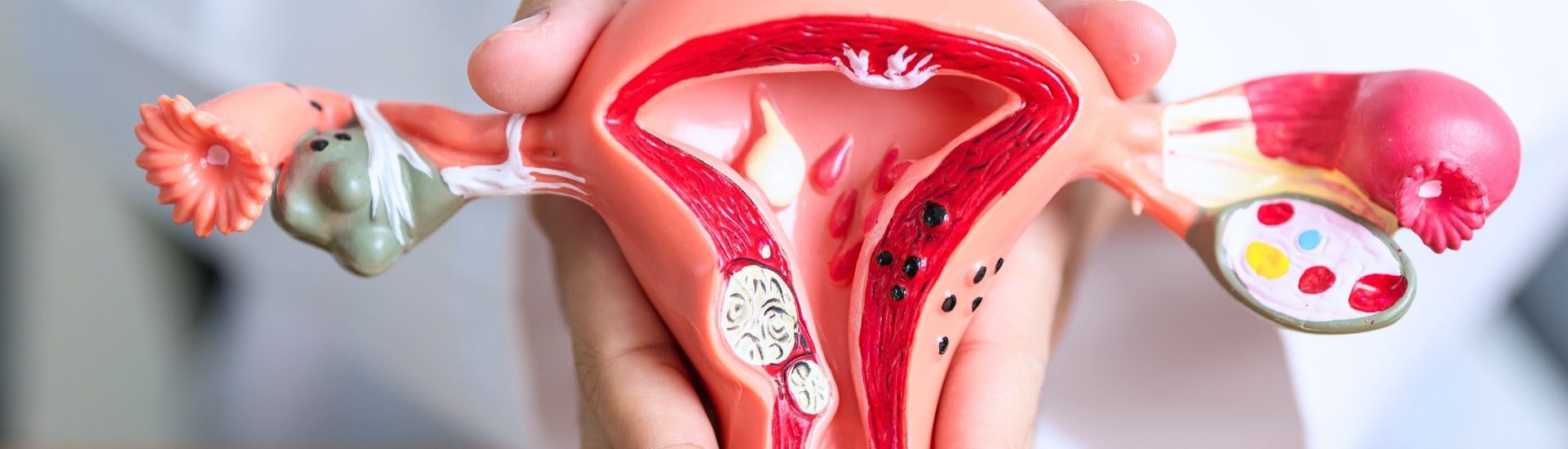 Trattamento dei fibromi - Medical Group